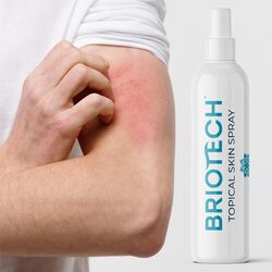 BRIOTECH Topical Skin Spray, Hypochlorous Acid Spray for Body & Face, Eyelid Cleanser, HOCl Facial Mist, Support Against Irritation, Calm Redness, Soothe Foot & Scalp, Packaging May Vary, 3.4 oz, 1 ct